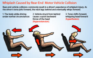 texas car accidents lead to whiplash injuries attorneys can help